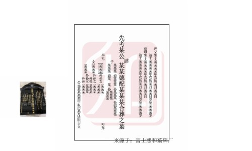 艾滋病关节痛的症状有哪些-艾滋病人是身体合关节疼吗网 :分享艾滋病关节会疼吗-艾滋病引起的关节疼是全身的吗知识